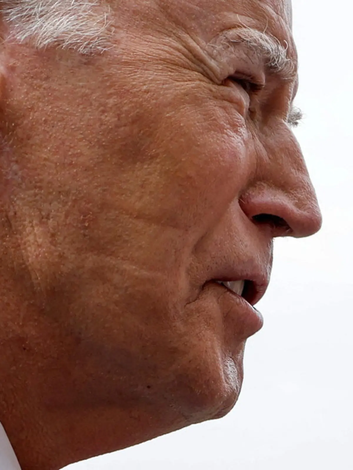 U.S. President Joe Biden carries marks left by the straps of a continuous positive airway pressure machine, or CPAP, visible on his face as he talks to reporters at the White House in Washington, U.S. June 28, 2023.  REUTERS/Jonathan Ernst