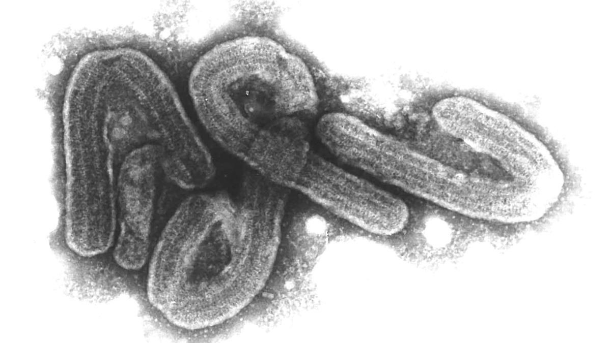 Suspicion of Marburg virus in Hamburg not confirmed