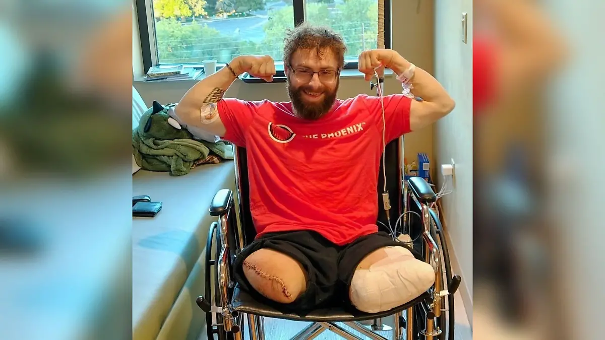 John O’Neill verliert beide Beine bei einem Unfall mit einem Holzhäcksler.