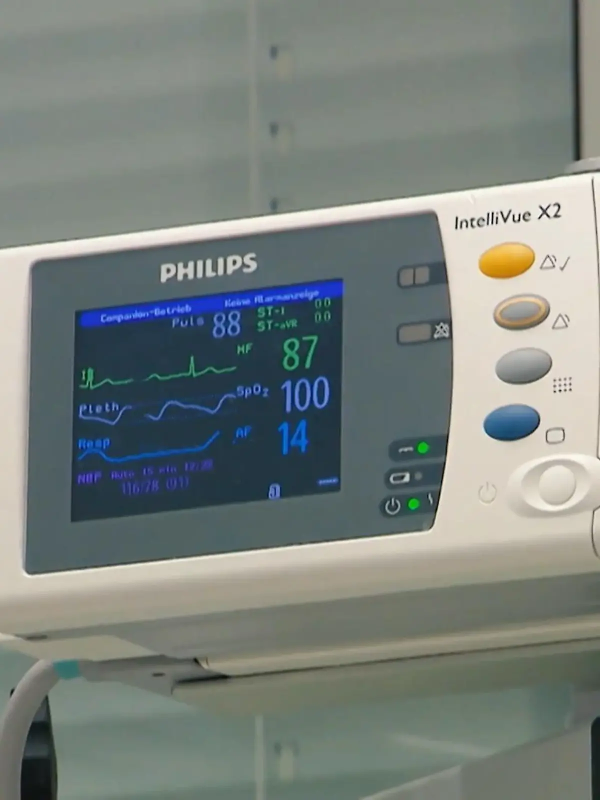 In der Uniklinik Essen warten drei Kinder auf eine Spender-Leber