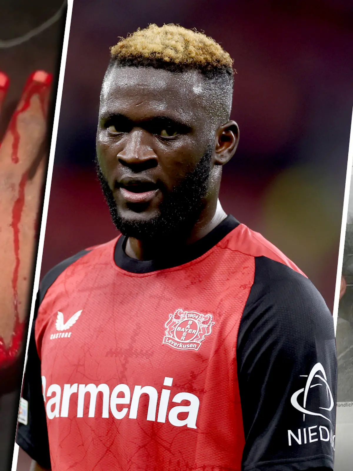 Boniface steht in Deutschland bei Bayer 04 Leverkusen unter Vertrag. Jetzt erlebt er einen furchtbaren Unfall.