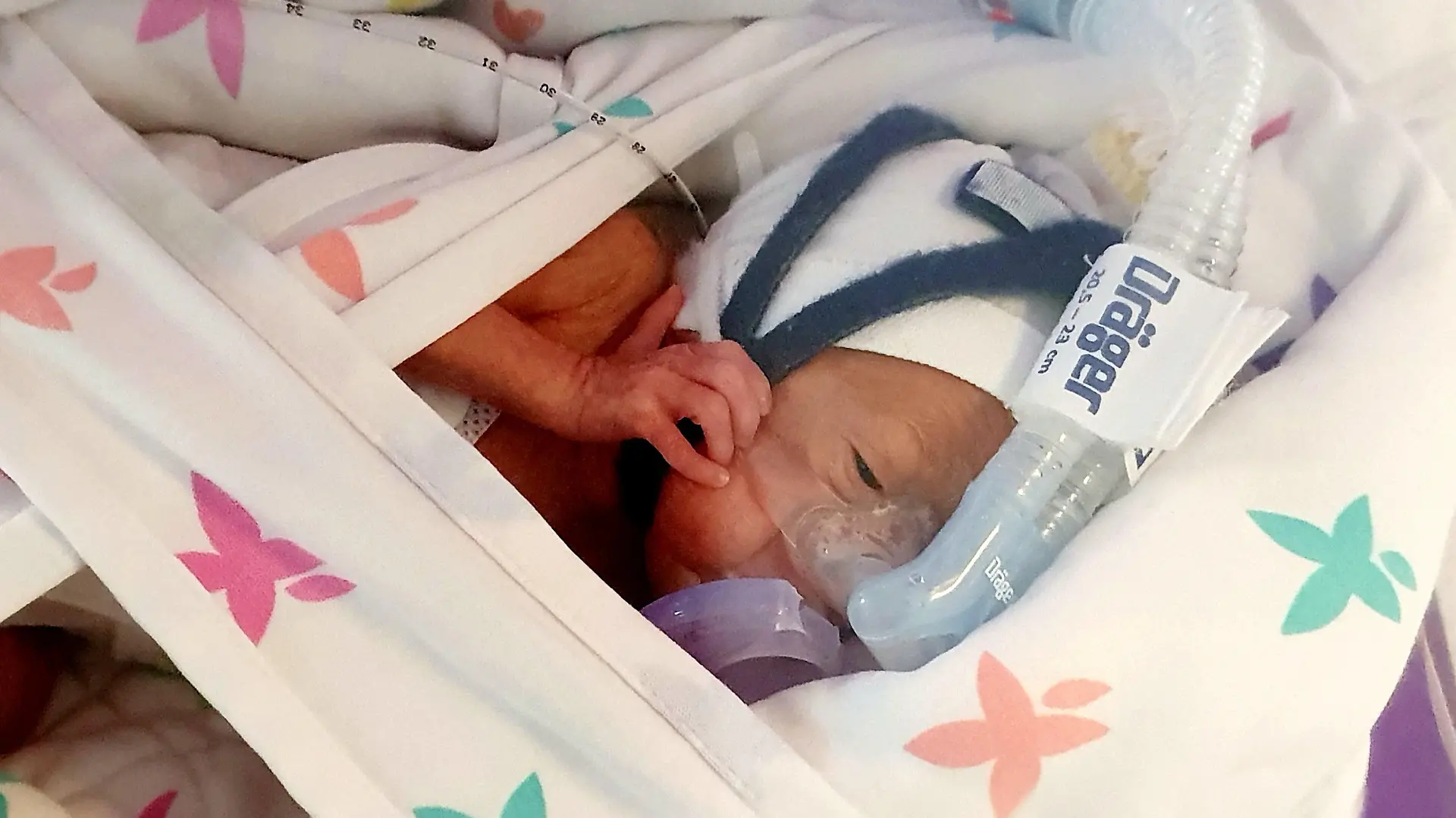SONDERKONDITIONEN: Satzpreis!
One of Britain?s tiniest babies born weighing 1lb 4oz was so small he had to be wrapped in a plastic bag moments after being born 101 days early. See SWNS story SWMDbaby. Baby Pace miraculously survived despite mum Isabella Gailbraith giving birth to the tiny baby boy at just 25 weeks. Brave mum Isabella was rushed to Worcester hospital after experiencing labour cramps just over six months into her pregnancy. After her waters broke, Isabella was transferred 72 miles to Bristol hospital where doctors tried to delay labour, but were forced to perform an emergency caesarean. The mum-of-four was forced to endure the whole procedure without an epidural due to medication that she had been given. Baby Pace was born on 11 March after NHS staff spent five days trying to delay the birth, he was immediately placed in intensive care. He was wrapped head-to-toe in a special plastic bag and placed in an incubator in a bid to keep the tiny tot warm. Mum Isabella and dad Pau, 42, have since been staying down in Bristol to keep watch over baby Pace, occasionally nipping home to Worcester to see their other children. Isabella, 33, who lives in Stourport, Worcs,. Said: ?We're getting there, slowly. / action press