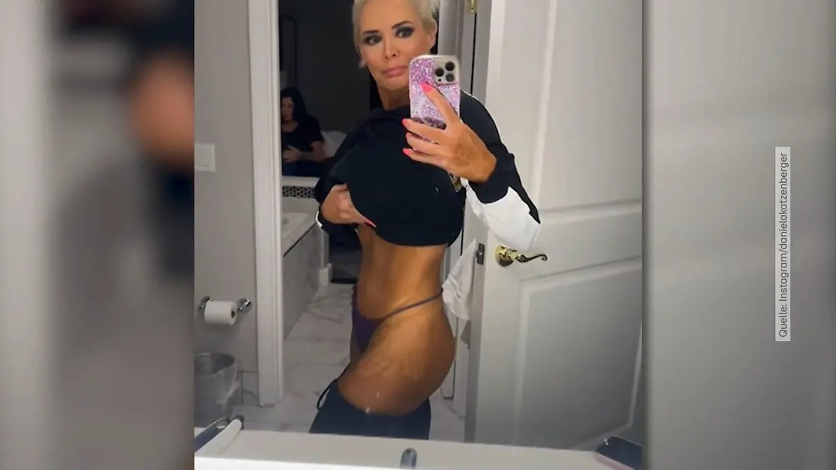 Daniela Katzenberger: Beauty-Fail in Las Vegas Plötzlich voller Flecken