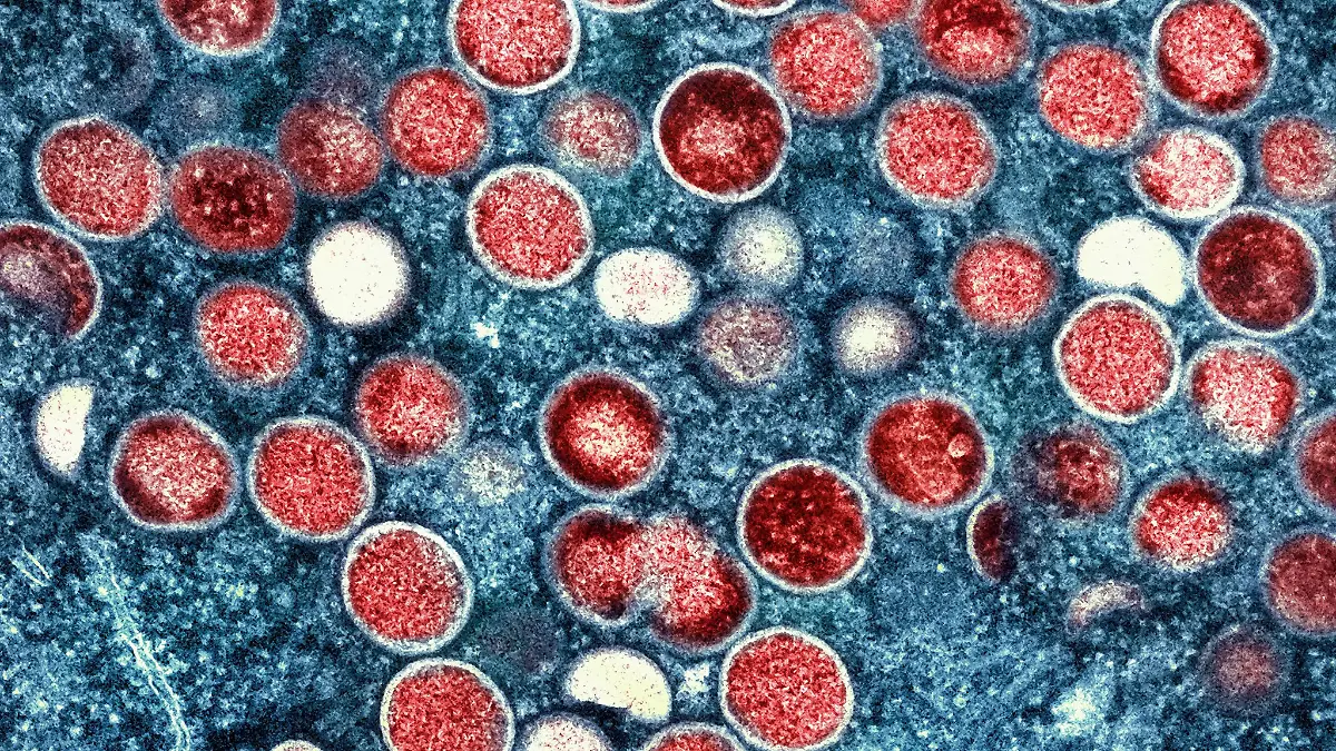 Eine eingefärbte Mikroskopaufnahme von Mpox-Partikeln. 