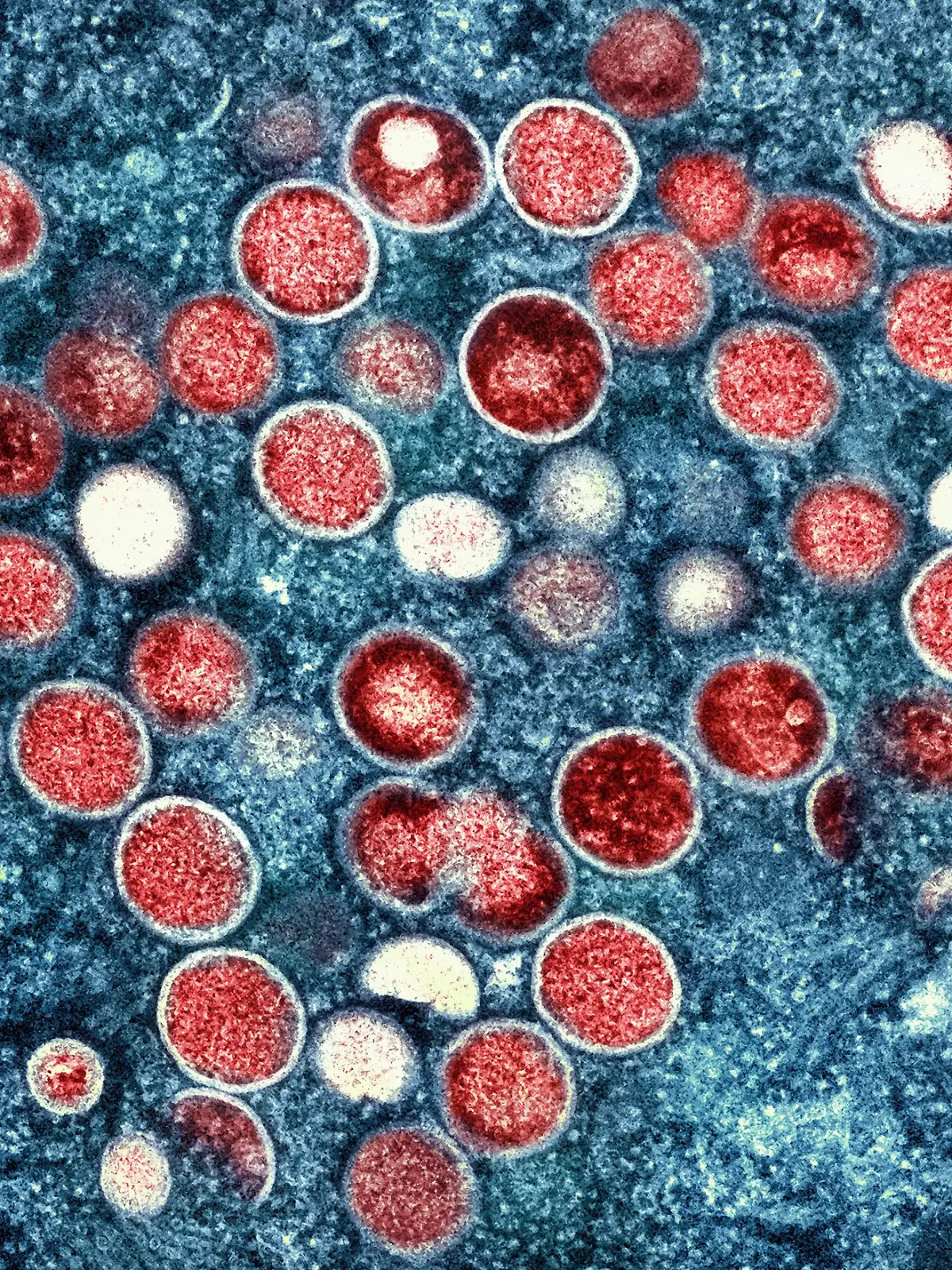 Eine eingefärbte Mikroskopaufnahme von Mpox-Partikeln. 