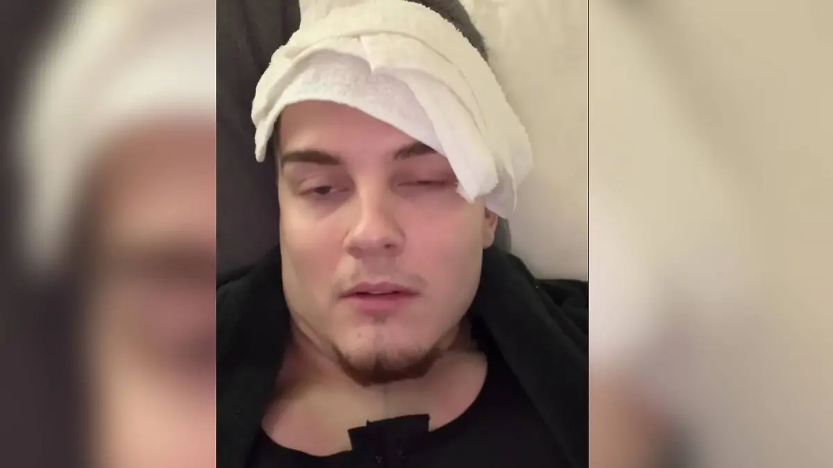 Twenty4Tim zeigt sich nach seiner Brust-OP erstmals den Fans.