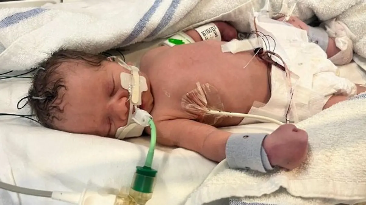 Wunderbaby kämpft um sein Leben, nachdem die schwangere Emma Atkinson von einem Hochhaus gestürzt ist