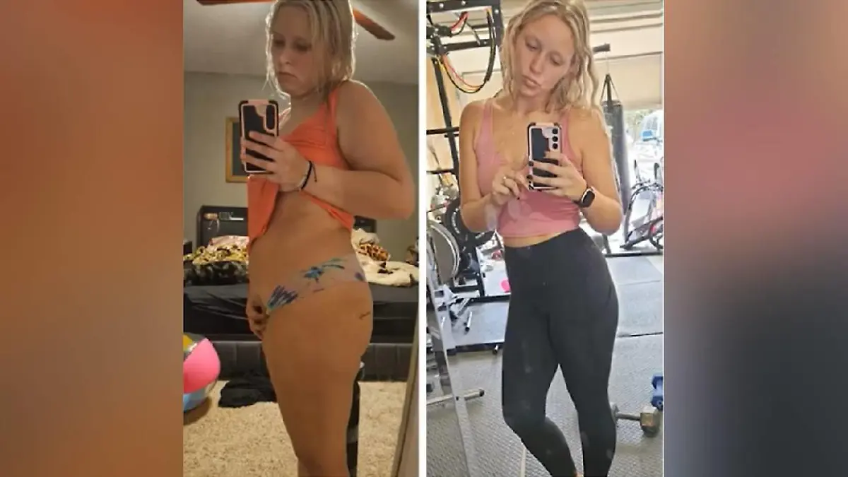 20 Kilo runter dank 10.000 Schritten am Tag?