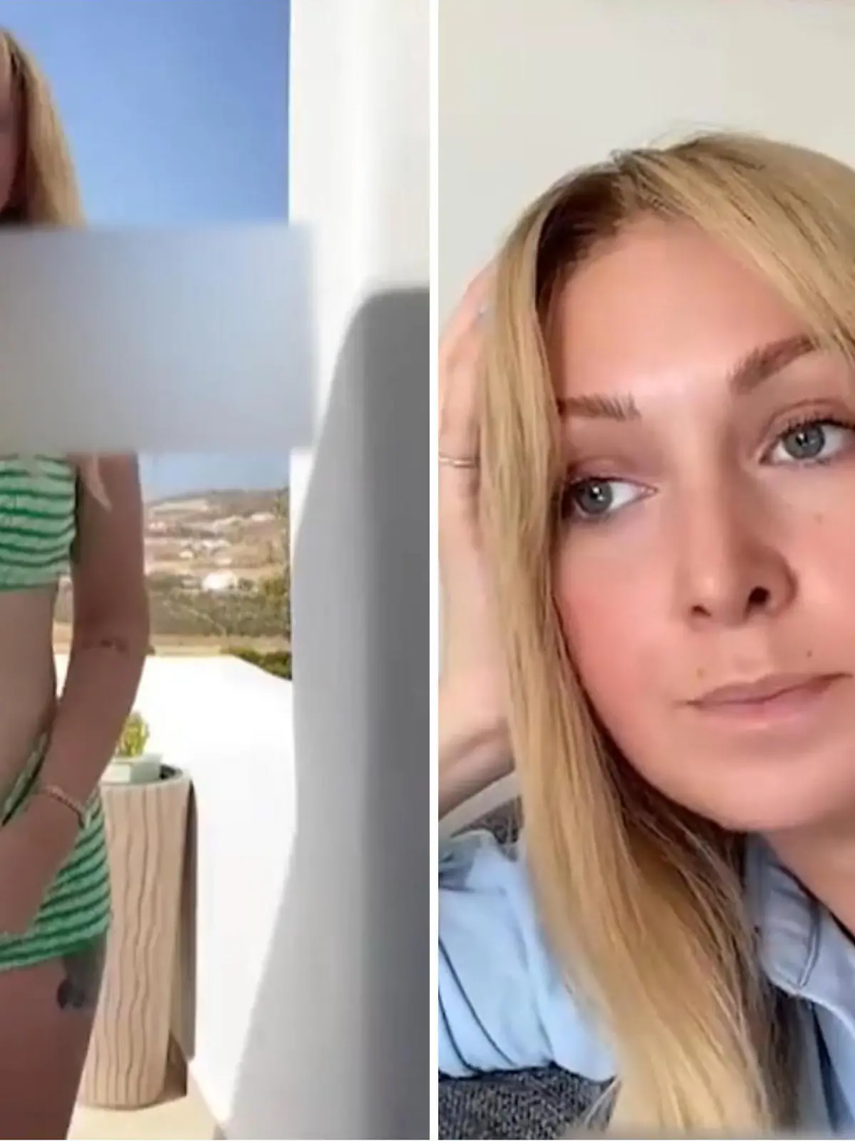 Bild zu: "Krebspatientin lässt Vagina mit ihrer Pobacke rekonstruieren"