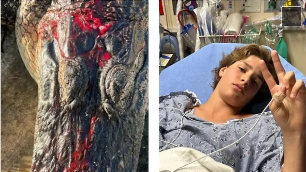 Der 13-jährige Gabriel Klimis aus Florida wurde von einem Alligator angegriffen.