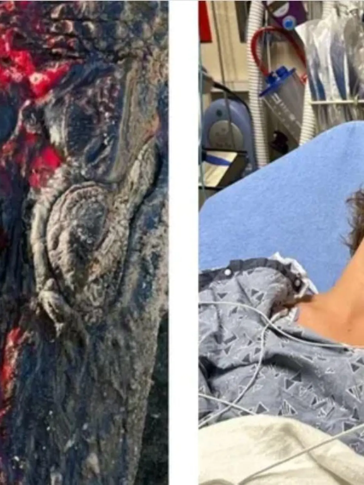 Der 13-jährige Gabriel Klimis aus Florida wurde von einem Alligator angegriffen.