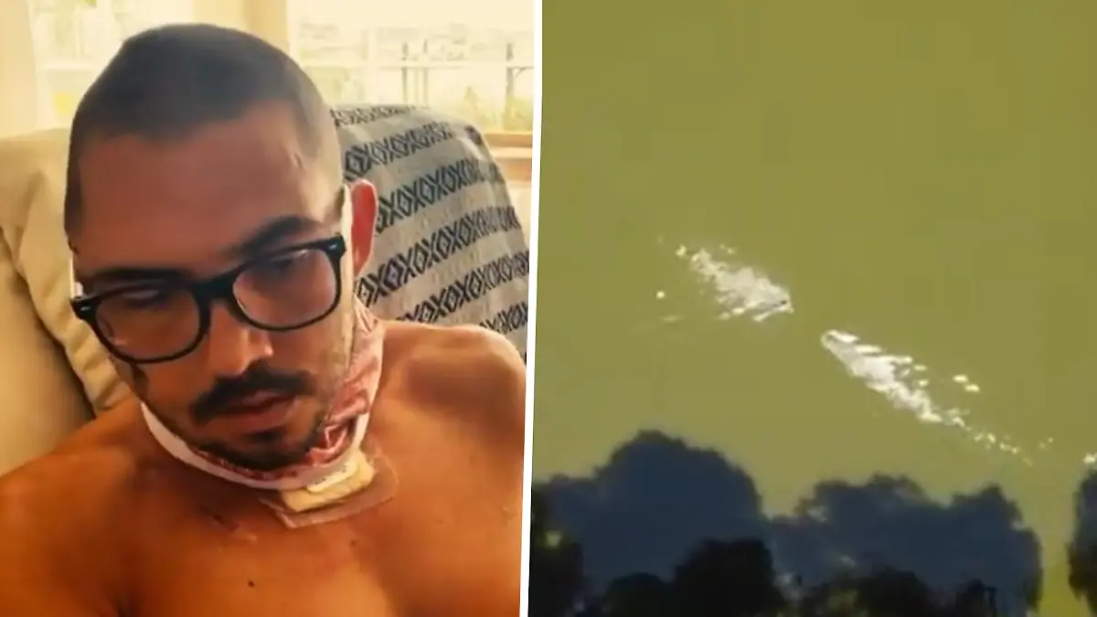Alligator greift Mann an - und beißt ihm in den Schädel! Unfassbar! Das hat er überlebt!