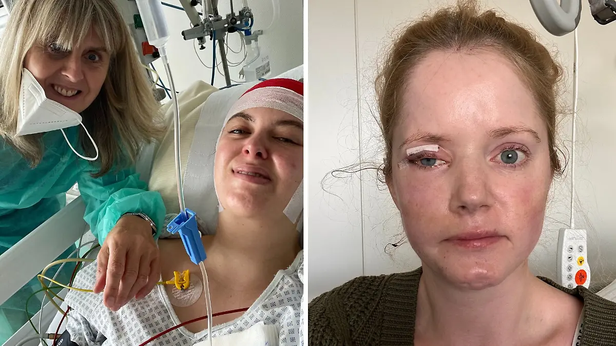 Links Greta nach einer der vielen Operationen, rechts Larissa.