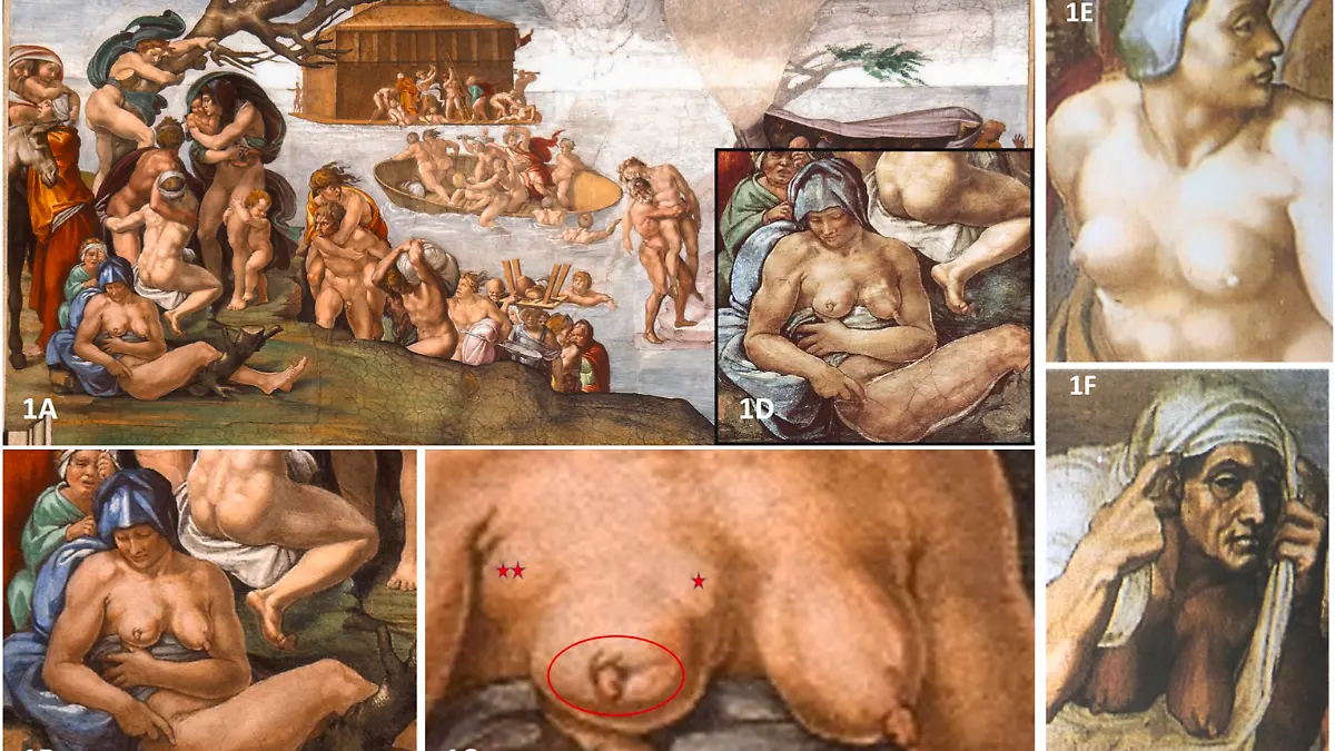 Ein internationales Experten-Team hat festgestellt, dass der berühmte Künstler Michelangelo schon vor hunderten von Jahren eine Frau mit Brustkrebs gemalt hat.