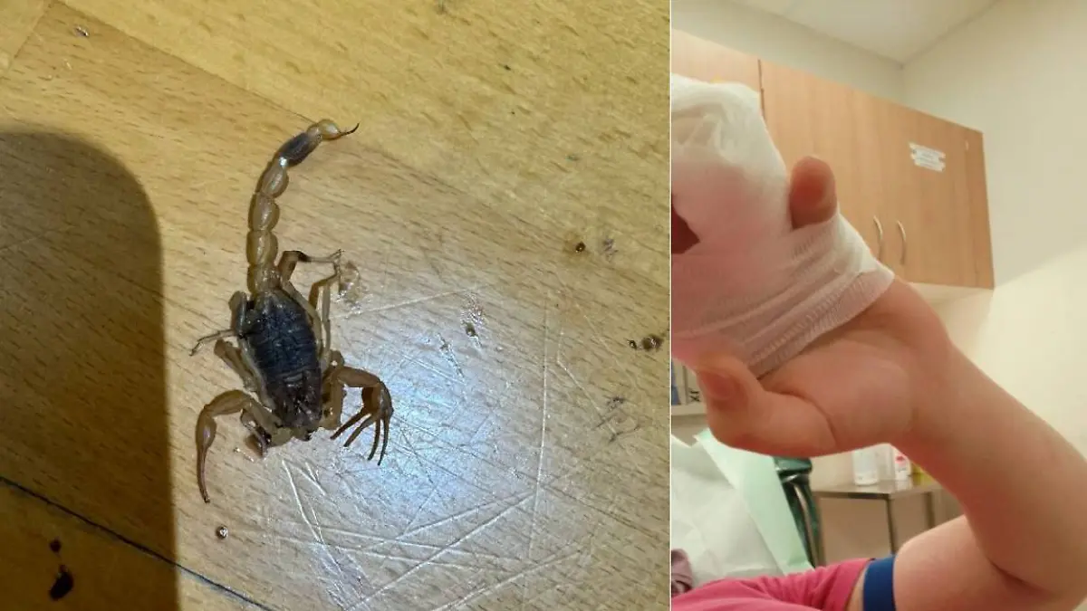 Skorpion sticht Frau in Marburg