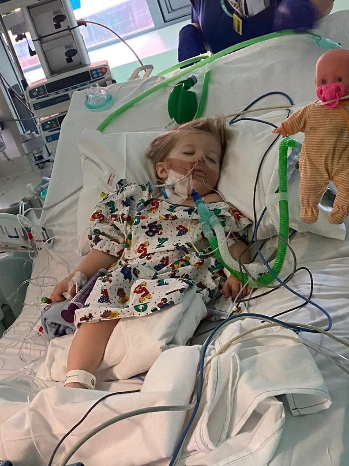 Chloe Crook receives treatment in hospital for Haemolytic Uraemic Syndrome (HUS). Release date November 10 2024. A two-year-old girl suffered a blood clot and was put in a coma after a horrendous bout of food poisoning while on holiday in Egypt. Chloe Crook jetted off to the five-star Jaz Aquaviva resort in Hurghada in July with her parents but began exhibiting debilitating gastric symptoms just two days later. She was then rushed to hospital by ambulance where she temporarily lost her vision and became non-verbal - before bruising appeared under the skin on her head. Tests later revealed her kidneys were not working properly, and she underwent emergency dialysis in a semi-sedated state.