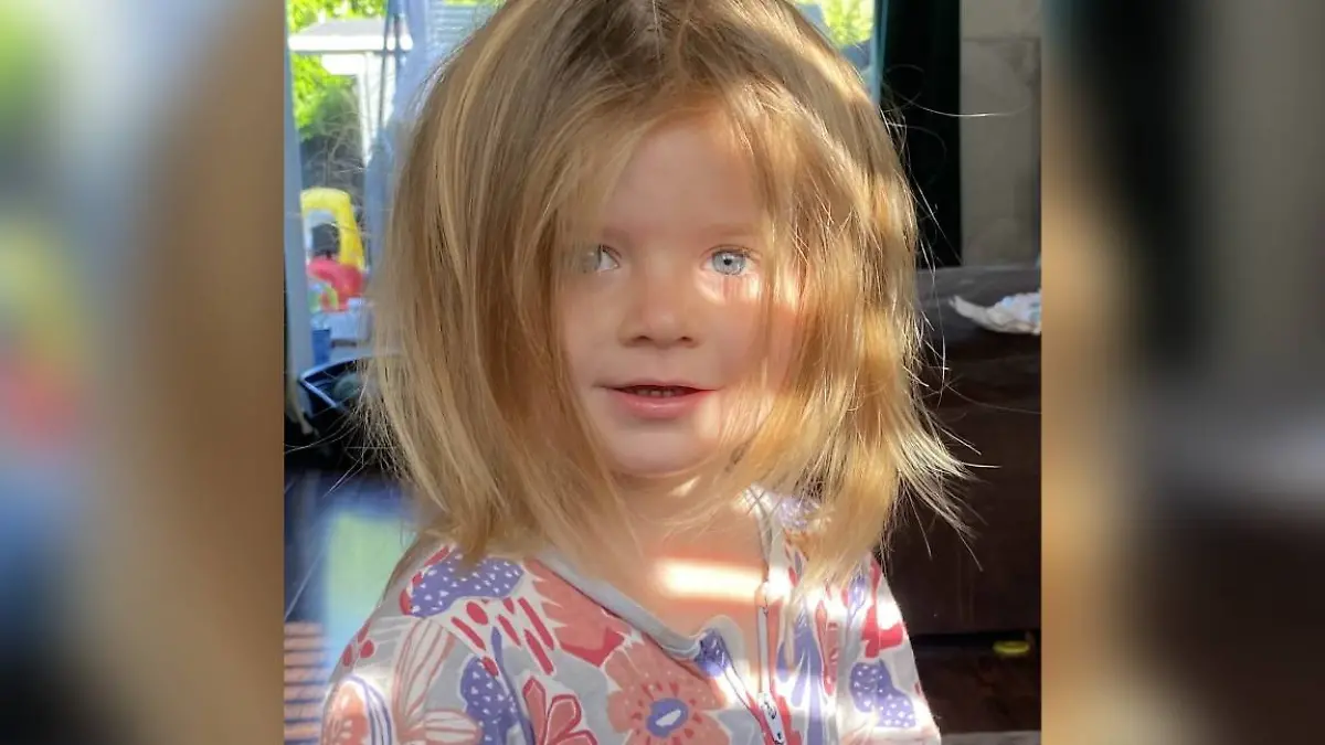 Chloe musste für vier Tage in ein künstliches Koma versetzt werden.