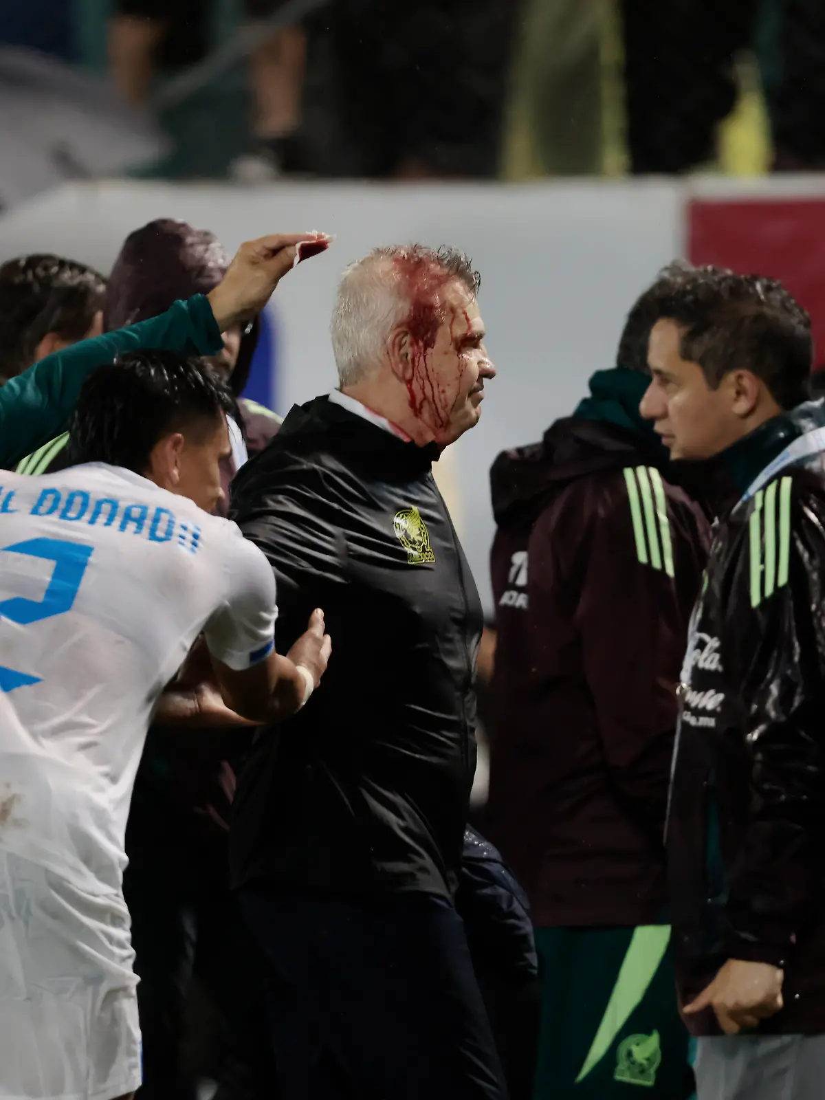 Bild zu: "Bierdosen-Eklat! Trainer geht blutüberströmt vom Platz
"