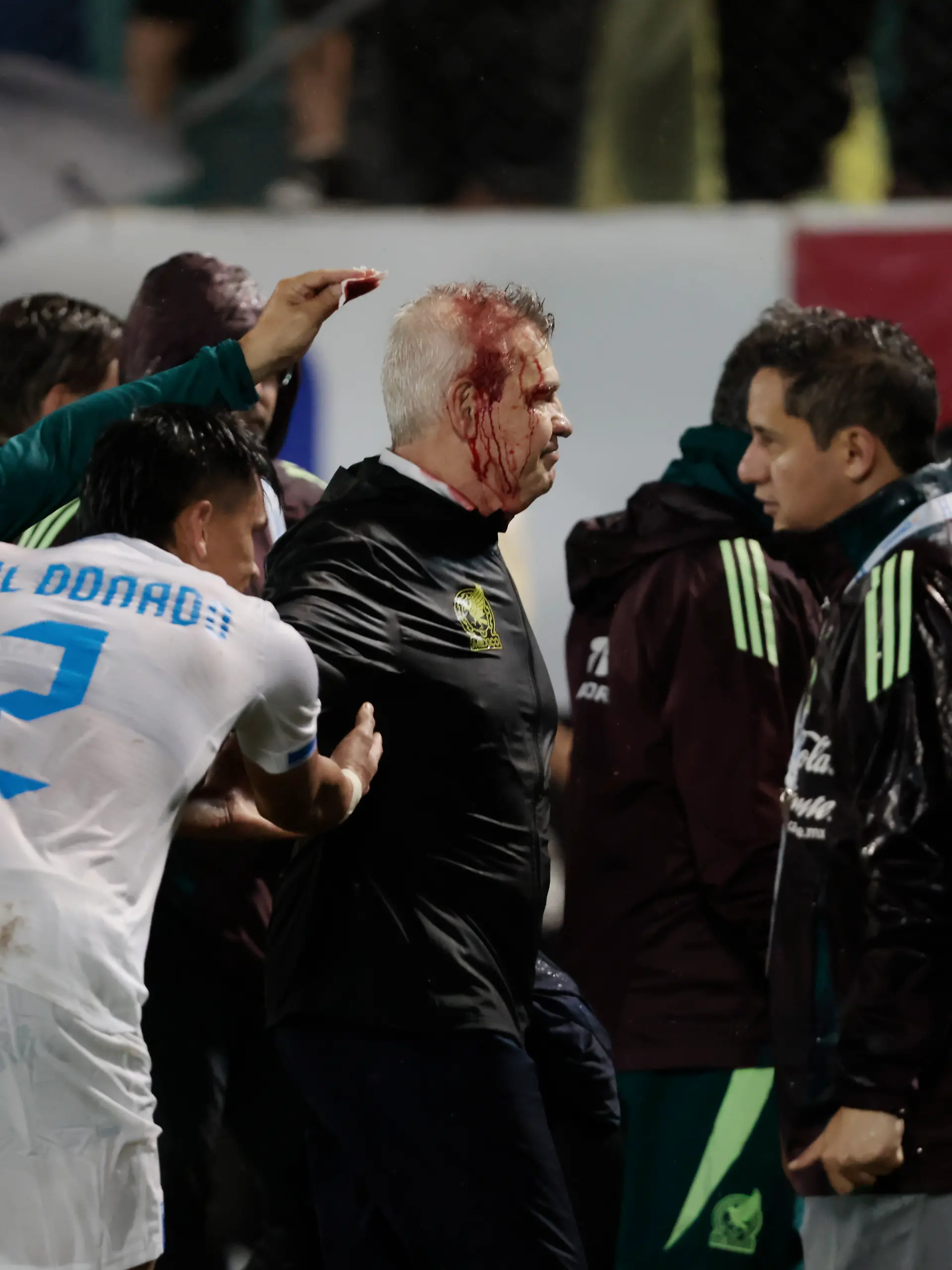 Bild zu: "Bierdosen-Eklat! Trainer geht blutüberströmt vom Platz
"