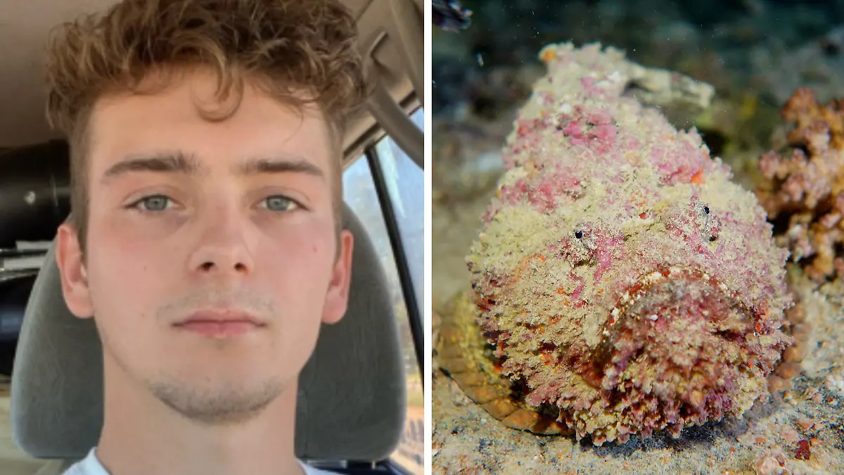 Kacper Krupa wurde in Australien von einem Steinfisch gestochen.