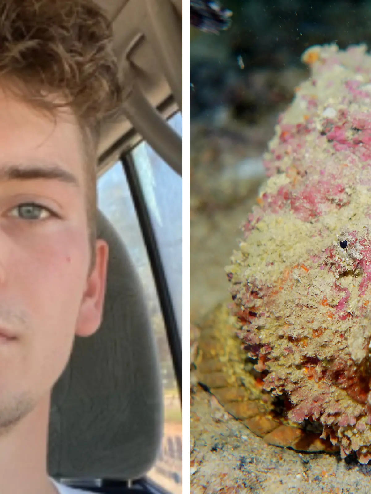 Kacper Krupa wurde in Australien von einem Steinfisch gestochen.