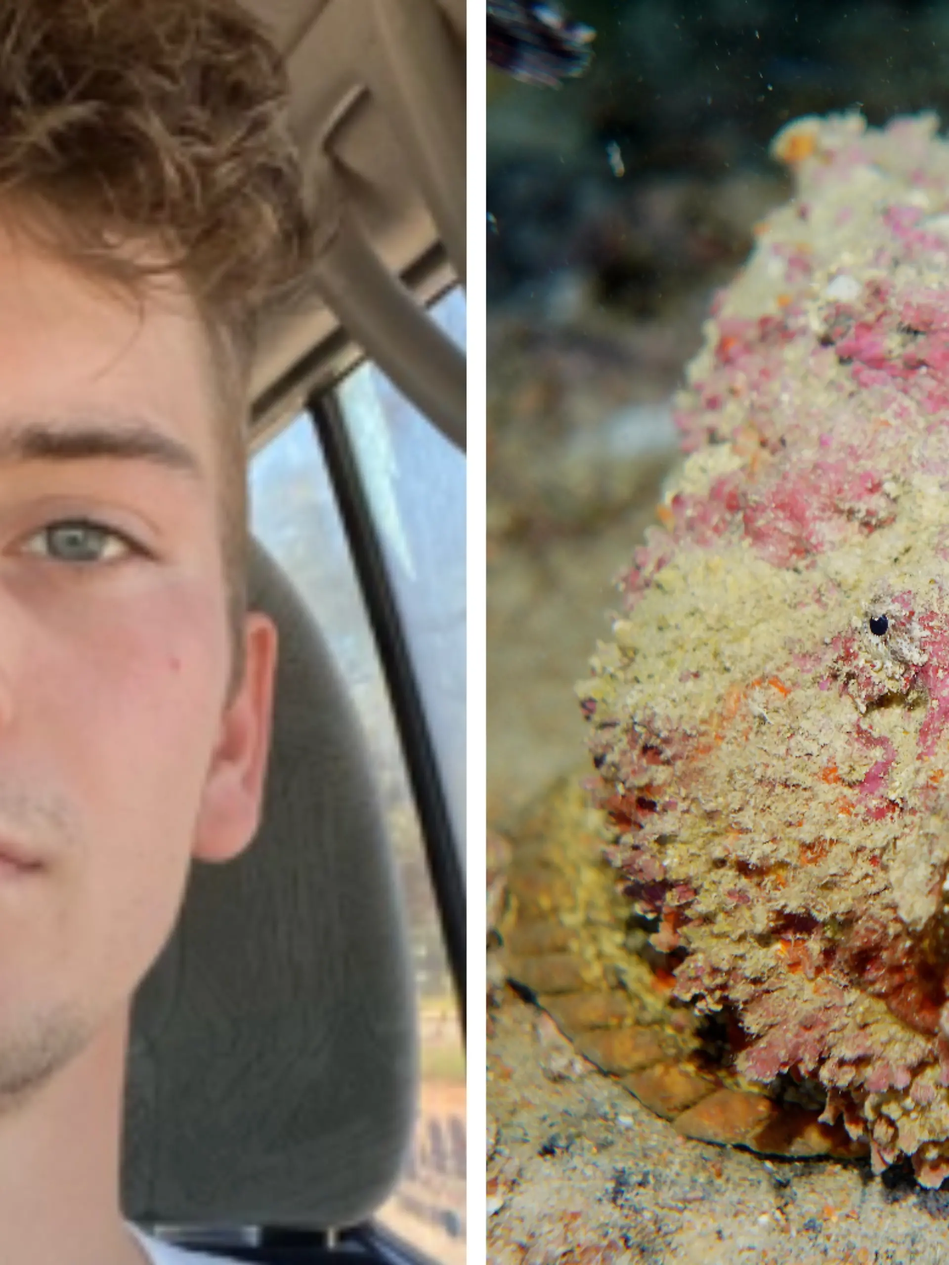 Kacper Krupa wurde in Australien von einem Steinfisch gestochen.