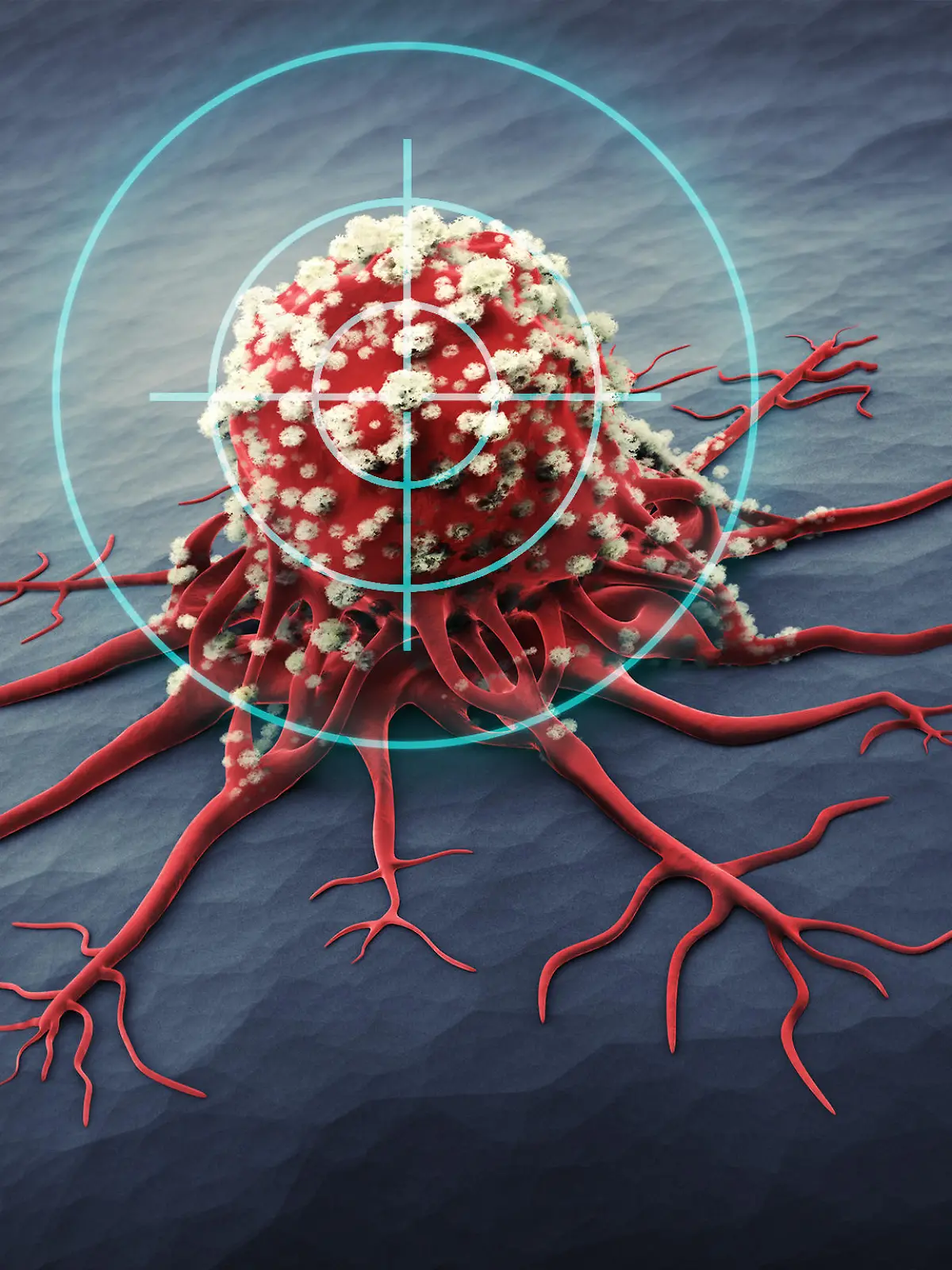 3D Rendering of a cancer cell - medical illustration