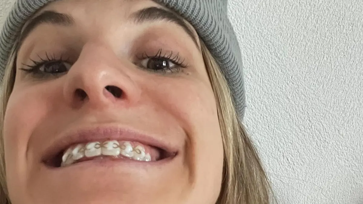 Nach ihrem Zusammenprall kann Alina Meier schon wieder Lachen.