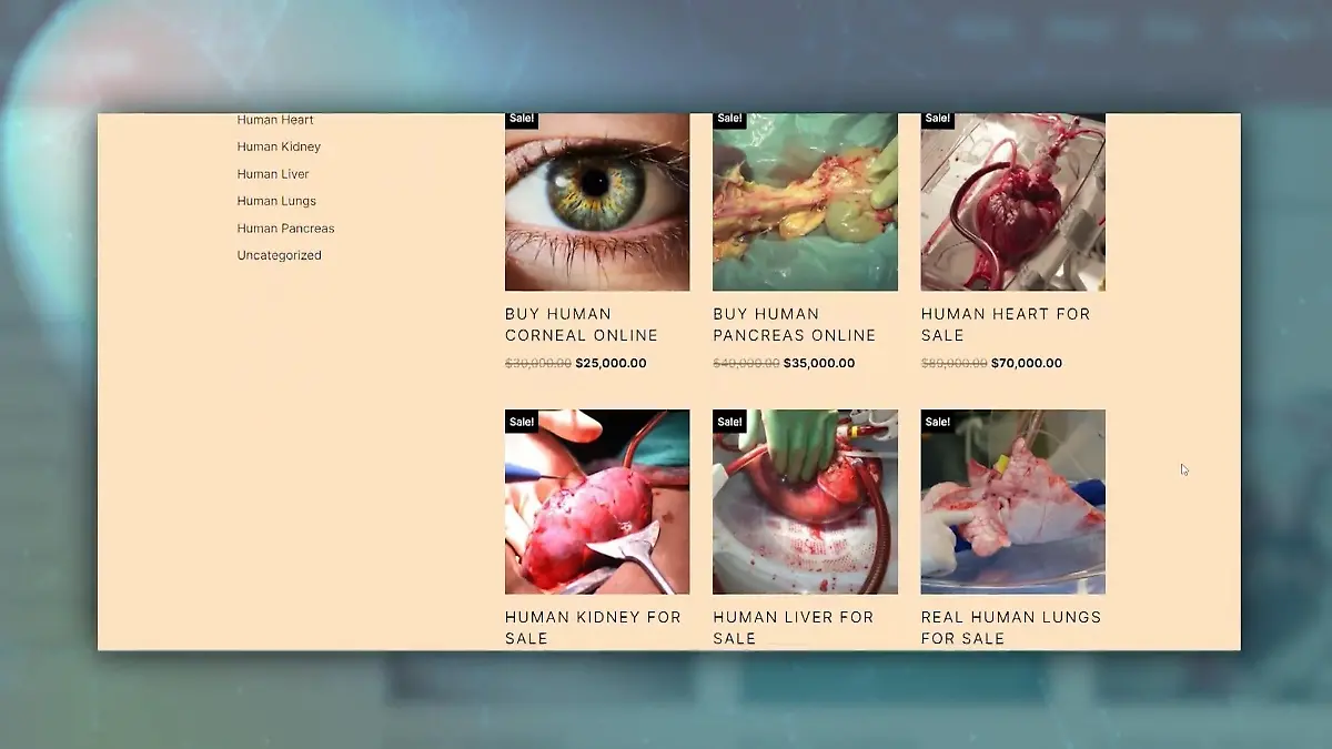 150.000 Euro! Ehepaar kauft lebensrettende Niere im Internet Illegaler Organhandel boomt