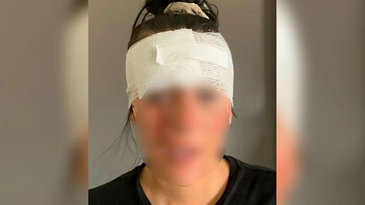Kienas Verletzungen sollen laut ihrem Ex-Freund aus Versehen oder beim Versuch, sie aufzuhalten, entstanden sein.