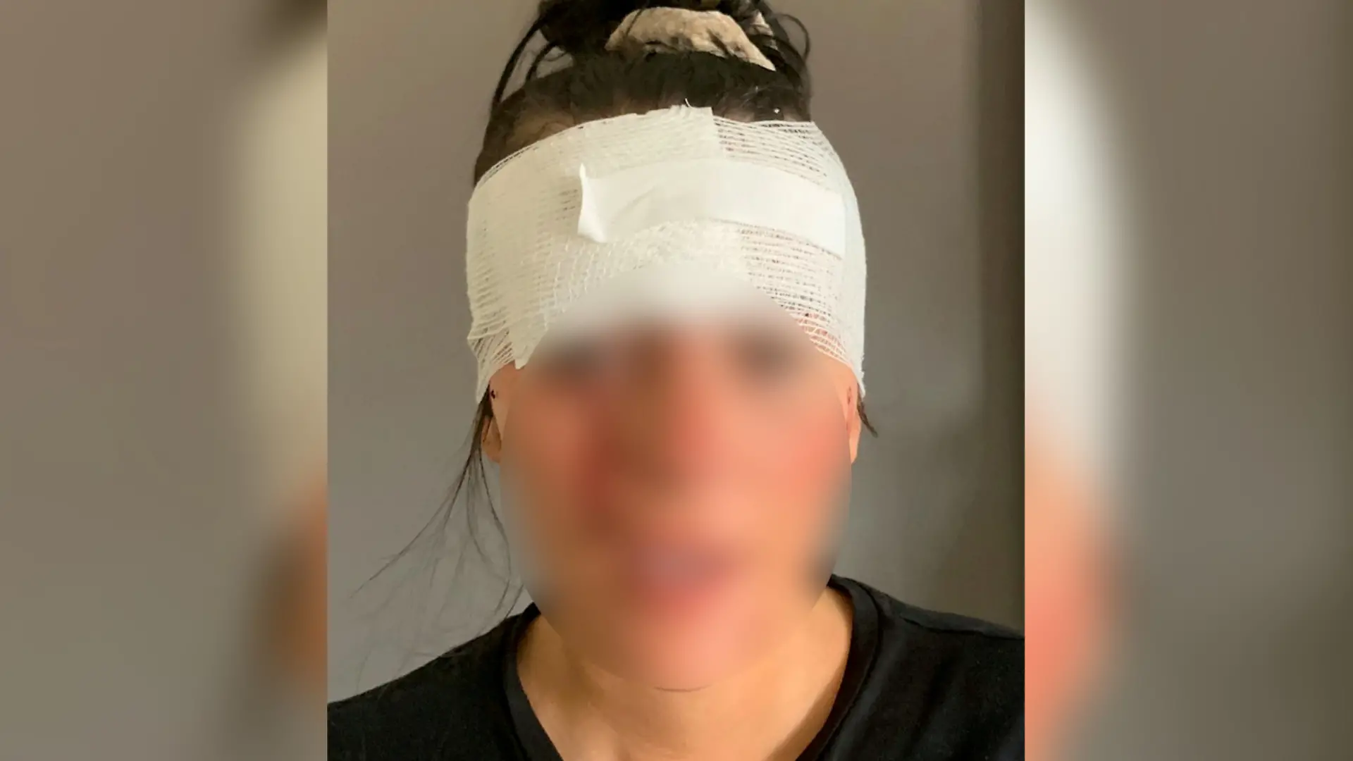 Kienas Verletzungen sollen laut ihrem Ex-Freund aus Versehen oder beim Versuch, sie aufzuhalten, entstanden sein.