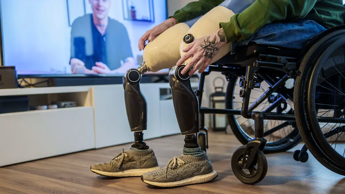 Alexander Sauer zeigt seine beiden Hightech-Prothesen in seinem Wohnzimmer.
