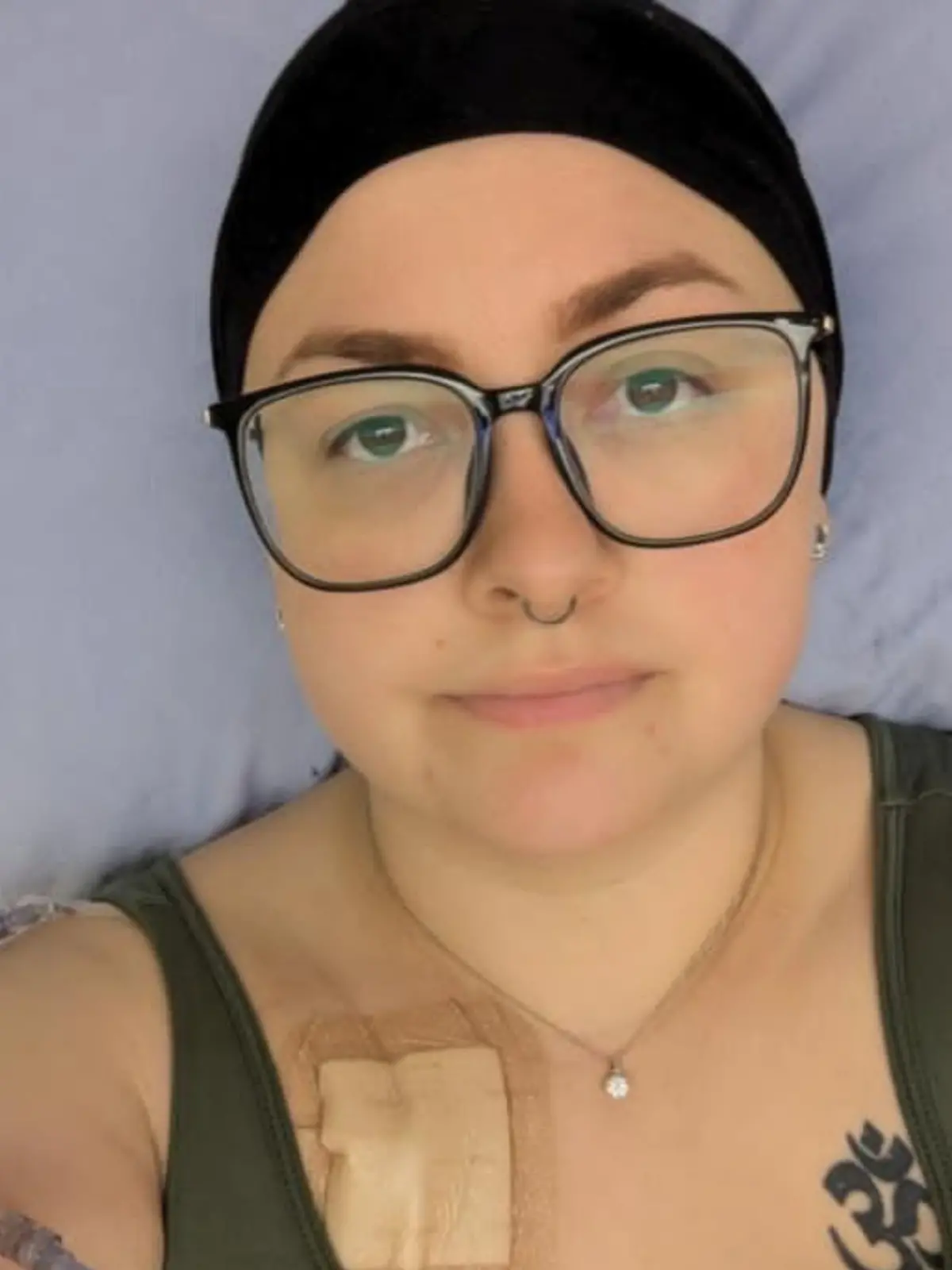 Taylor Deanne Roy (32) aus Kanada dachte jahrelang, sie leide an einer Hautkrankheit. Doch es steckt etwas ganz anderes dahinter.