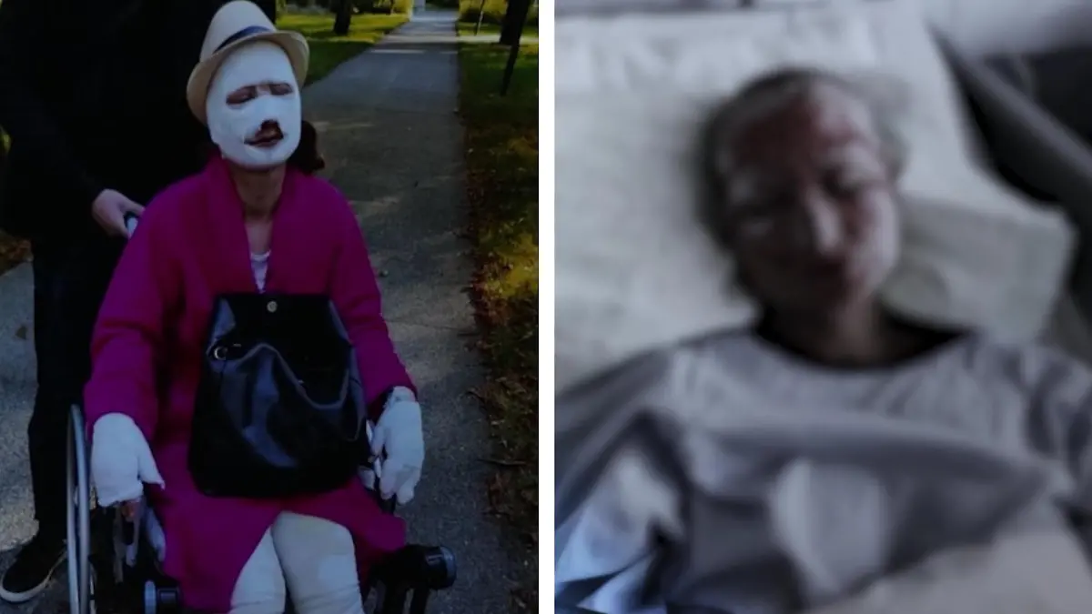 Brandschutzbeauftragter zündet Kollegen auf Betriebsfeier an Gina „hatte Todesangst“