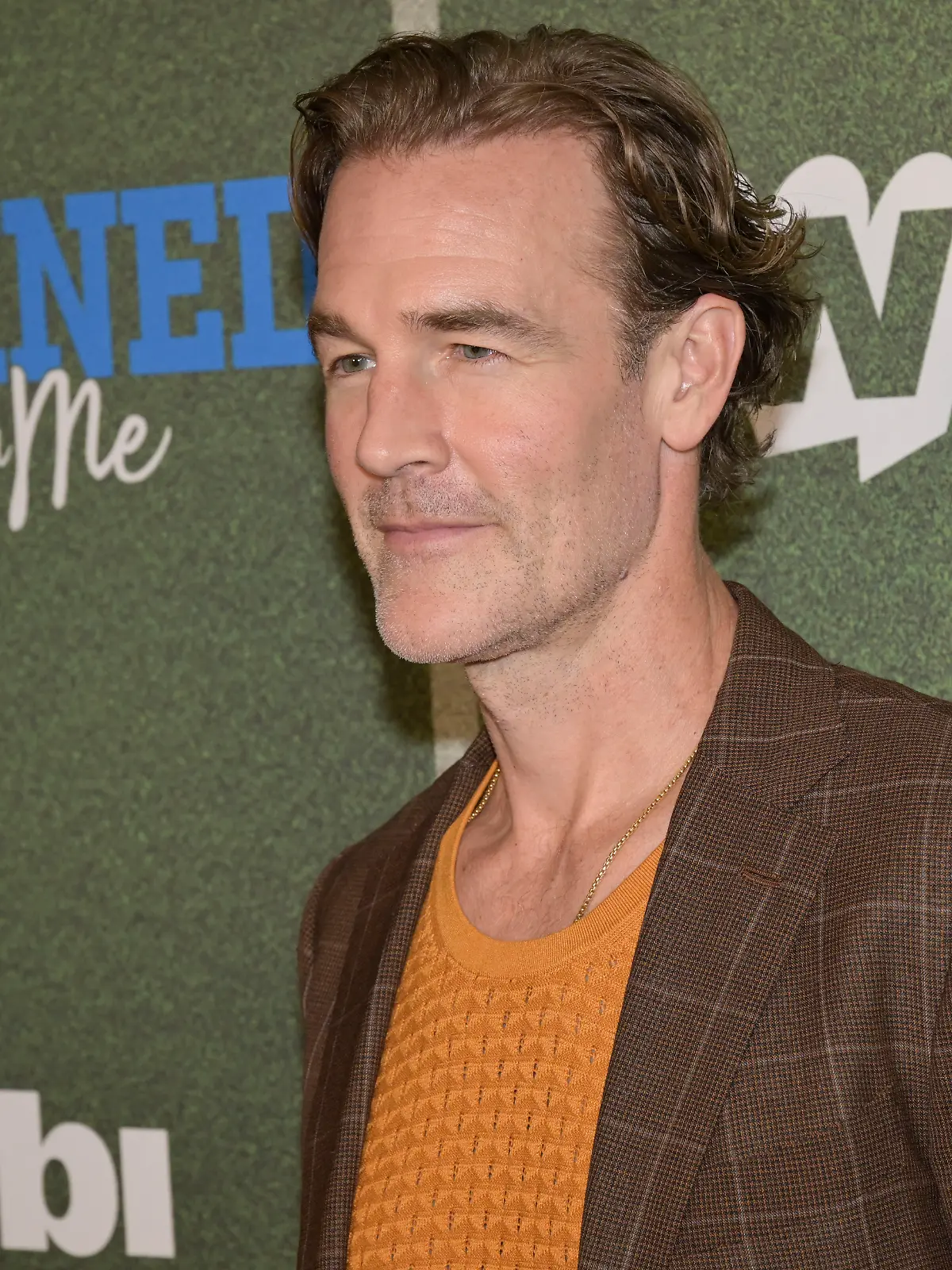 Bild zu: "Warum James Van Der Beek dem Krebs auch dankbar ist"