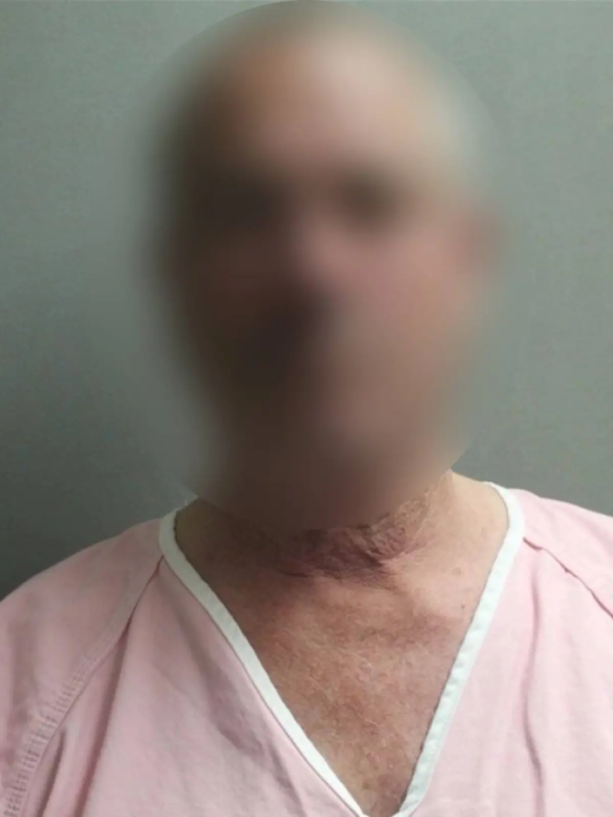 Der 68-jährige Texaner soll seinen an Trisomie 21 erkrankten Sohn erschossen haben. Er behauptet, es sei ein Versehen gewesen. 