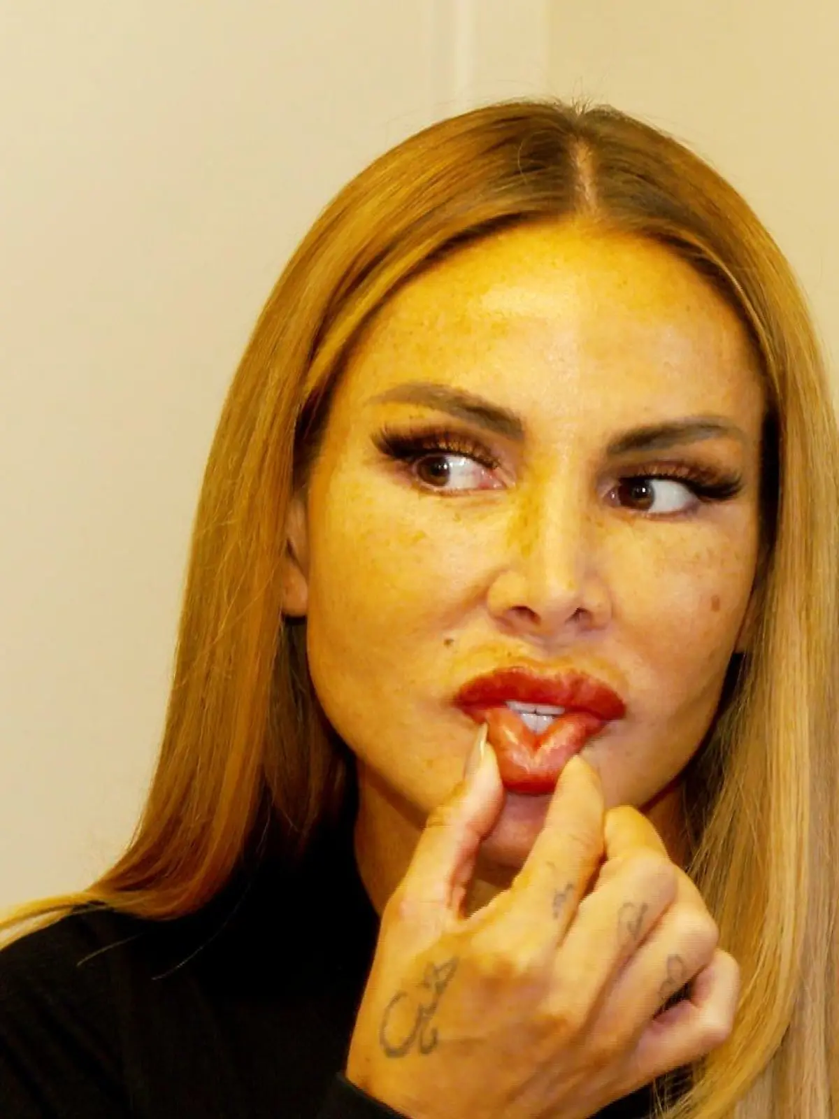 Bild zu: "Lisha lässt sich die Lippen verkleinern"