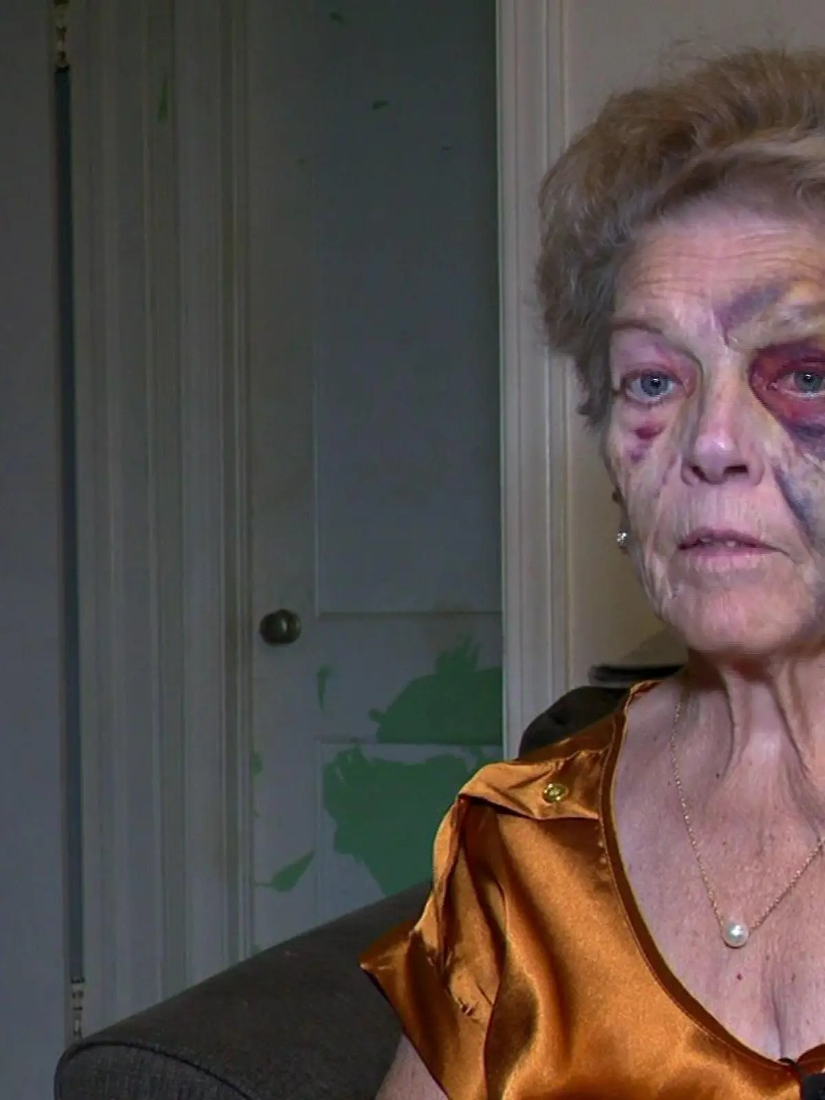 Shirlene Hernandez (72) wird überfallen und verprügelt. Der Täter klaut das Auto der Großmutter - und stirbt wenig später.