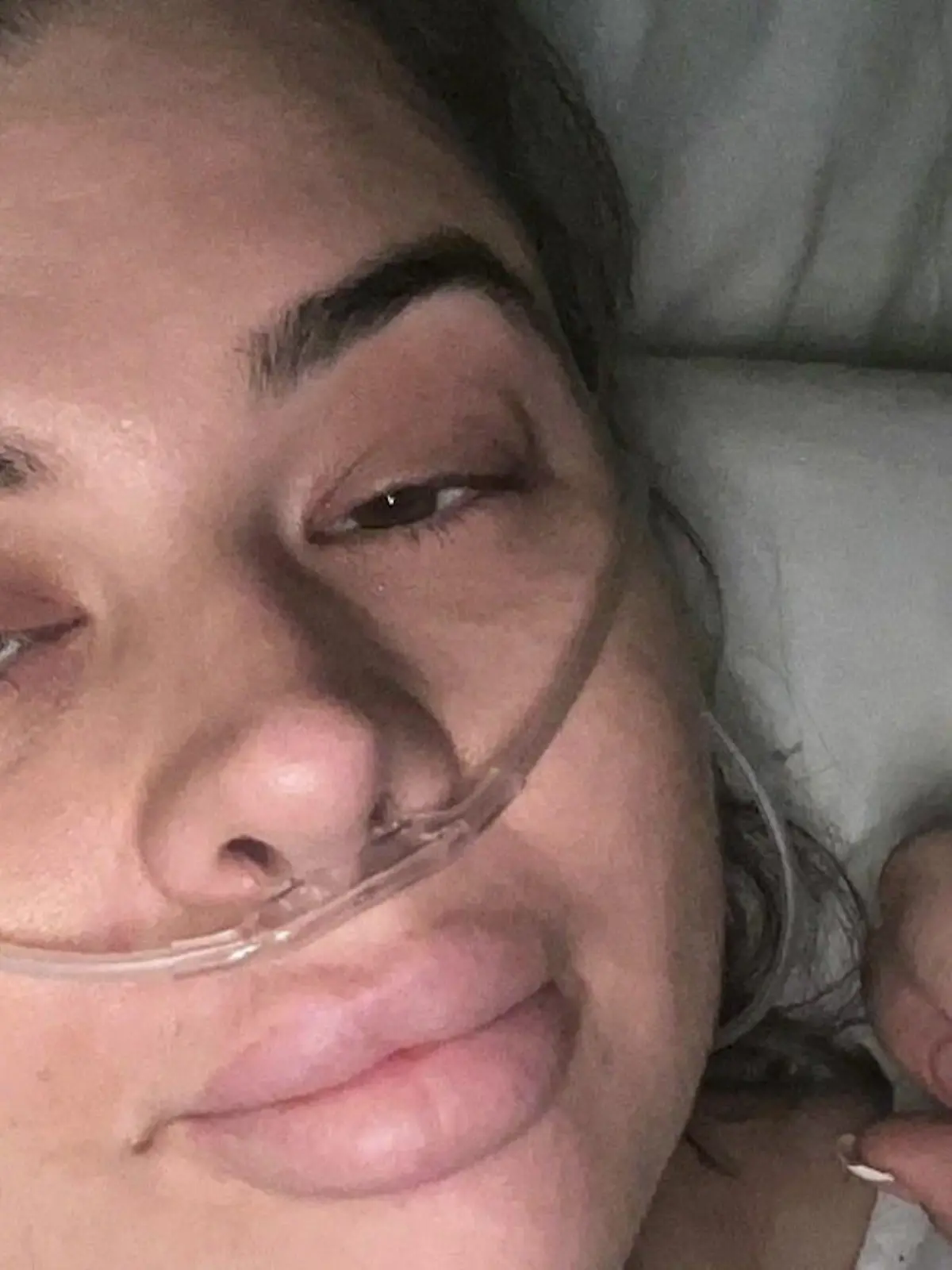 Bild zu: "Jade (31) unterzieht sich „Mami-Makeover” – danach hat sie nur noch eine Brust"