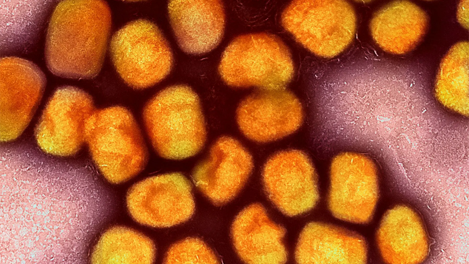 In Deutschland ist zum zweiten Mal die neue Variante des Mpox-Virus nachgewiesen worden, vier Mitglieder einer Familie im Rheinisch-Bergischen Kreis bei Köln sind erkrankt (Archivbild).