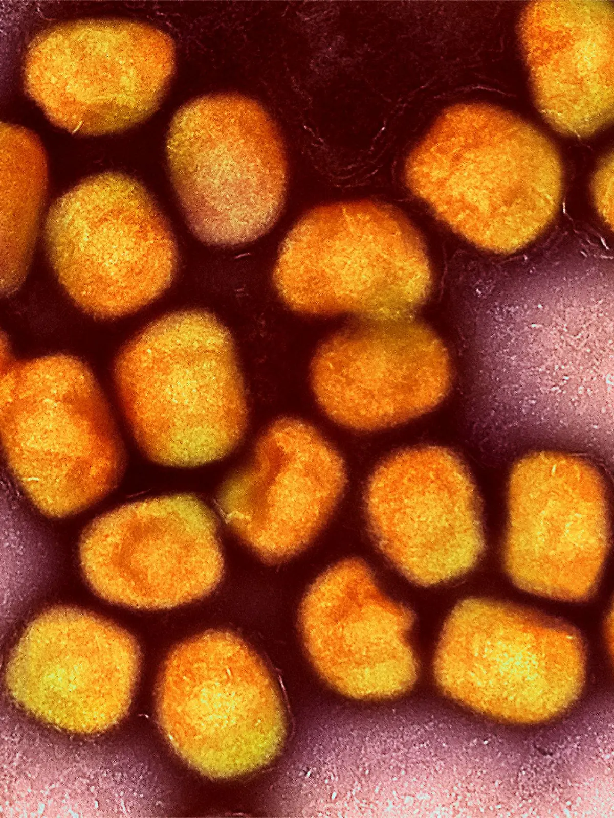 Bild zu: "Schule in NRW wegen Mpox geschlossen "