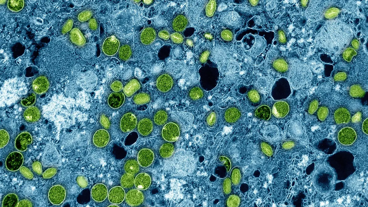 Das Mpox-Virus unter dem Elektronenmikroskop.
