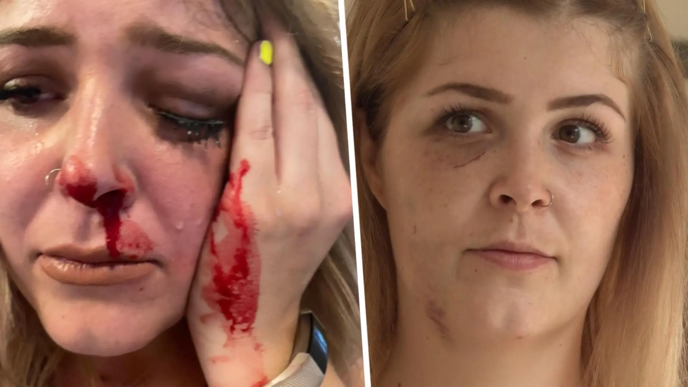 Sexuelle Belästigung: Sarah (28) wehrt sich - er schlägt zu! Begrapscht auf der Tanzfläche