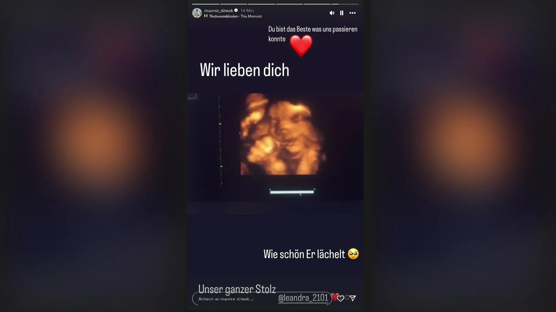 Maurice Dziwak teilt stolz ein Ultraschallbild seines Sohnes 