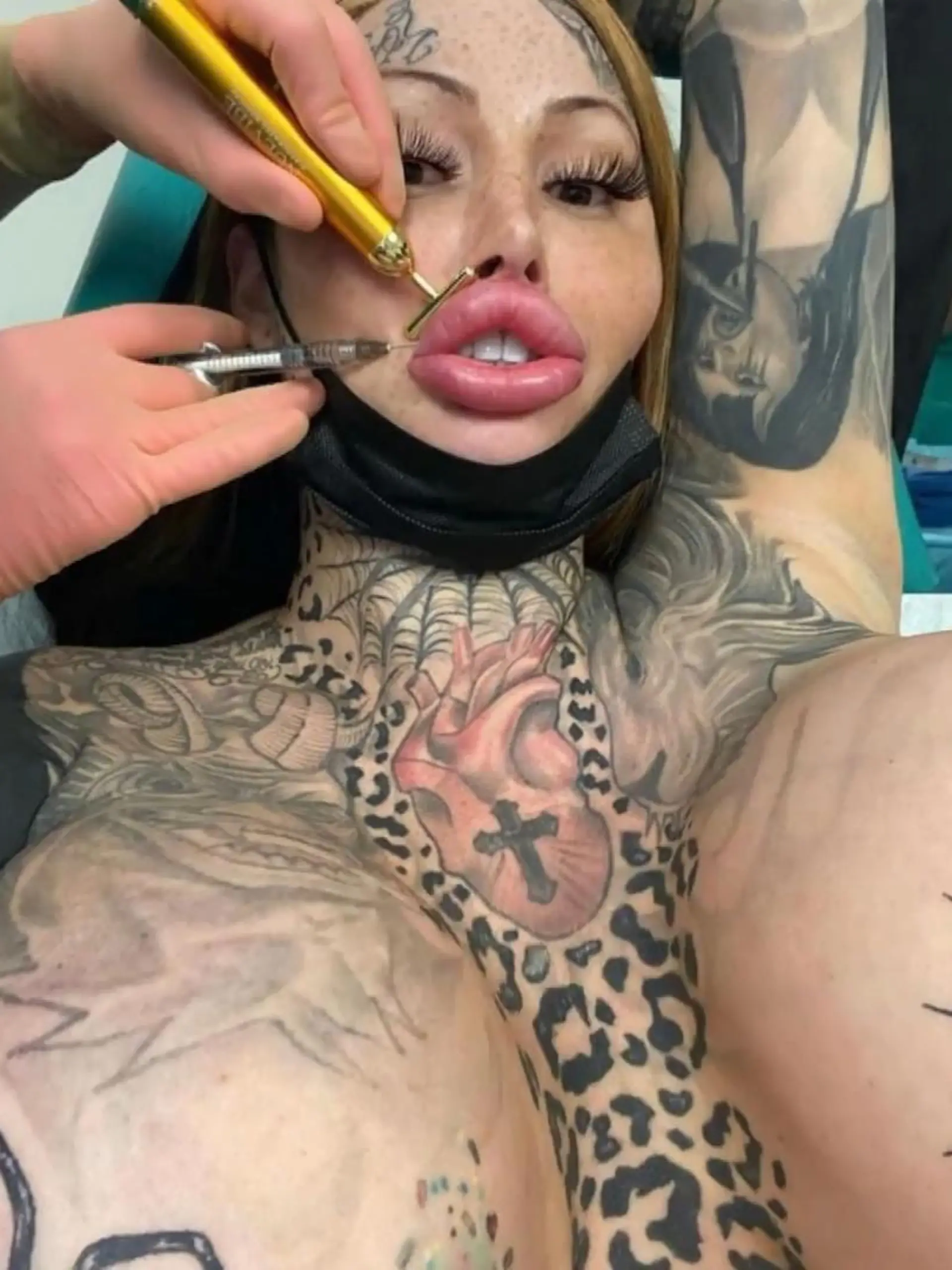 Jup, hier ist ordentlich was schief gelaufen. Mary Magdalene hat buchstäblich eine dicke Lippe riskiert - so dick, dass ihr Mund nun leider nicht mehr zu geht. Botoxbehandlung ist Mary nun erneut in aller Munde - nur sie selbst kann gerade wahrscheinlich nicht viel reden!