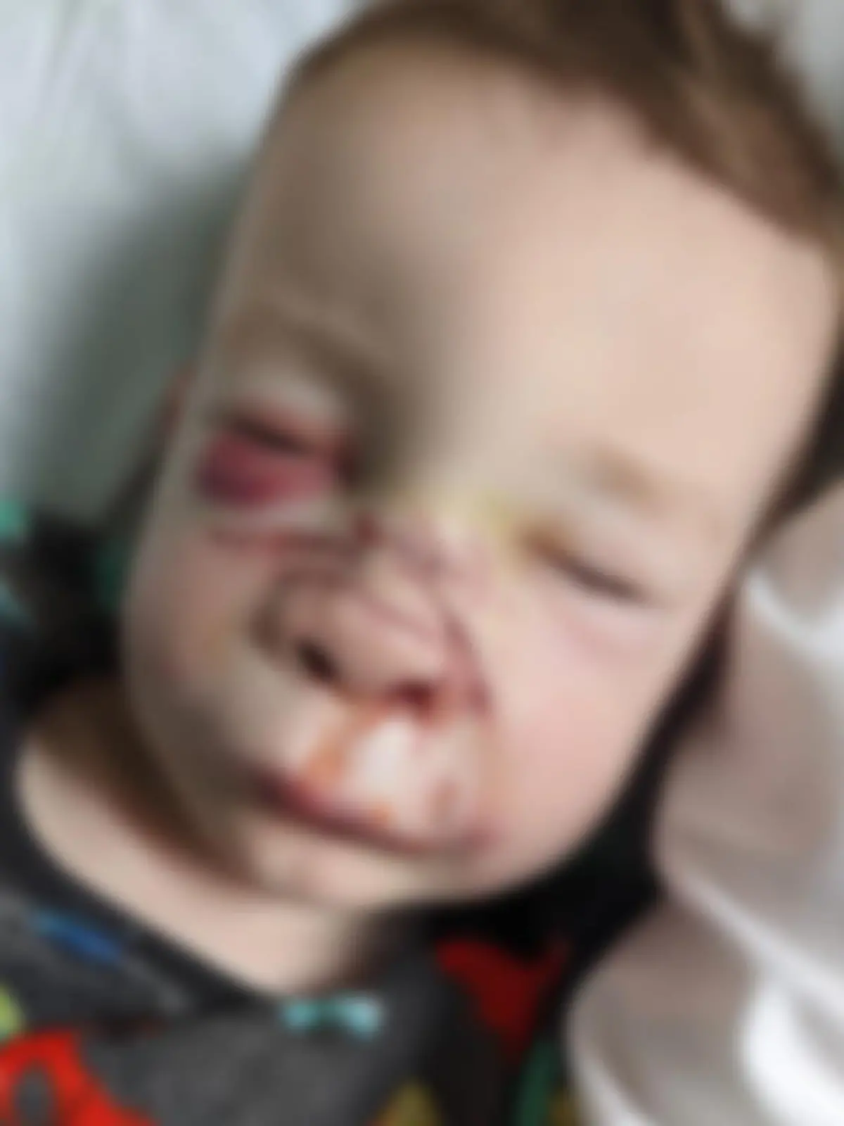 Eigentlich sind der kleine Romy und der achtjährige Familienhund namens Blizzard beste Freunde. Doch eines Tages kommt alles anders: Aus dem Nichts wird Romy von Blizzard gebissen, sodass sein Vater ihn blutüberströmt vorfindet und er im Krankenhaus operiert werden muss.