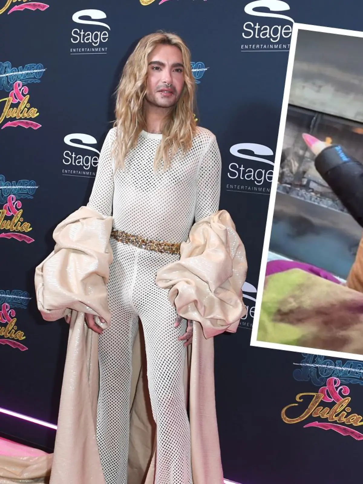 Bill Kaulitz hat Pech im Ski-Urlaub und das schon direkt am ersten Tag. 