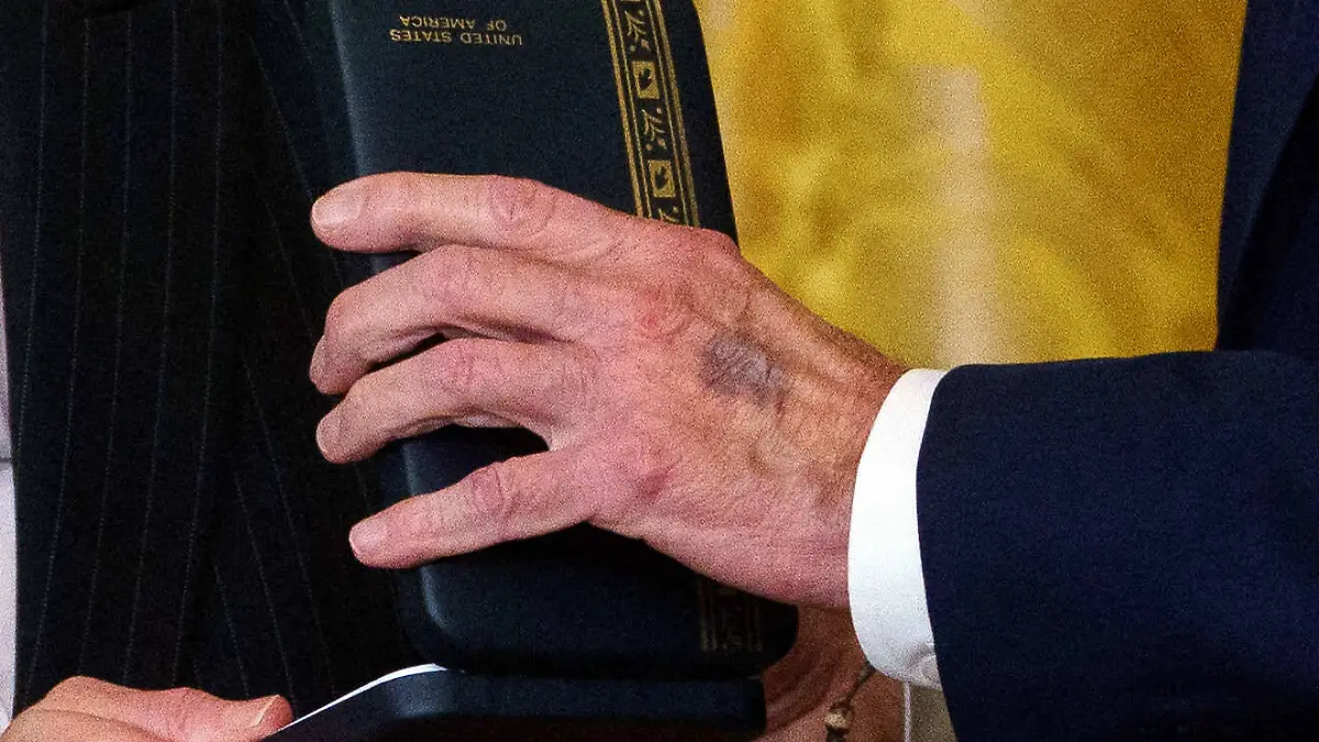 Der Fleck auf Joe Bidens Hand.