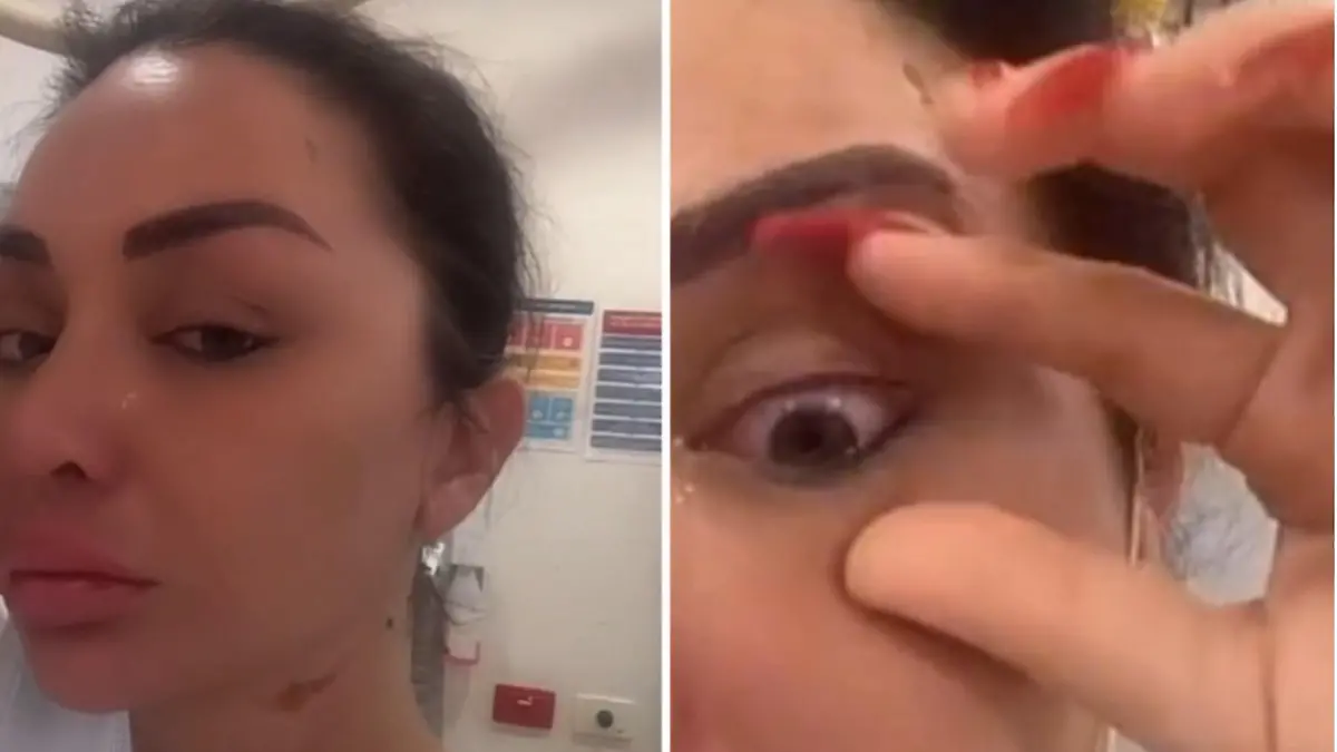 Tiktok-Star Jenny Elhassan streamt gerade live - als drei unbekannte und vermummte Männer sie mit Säure übergießen.