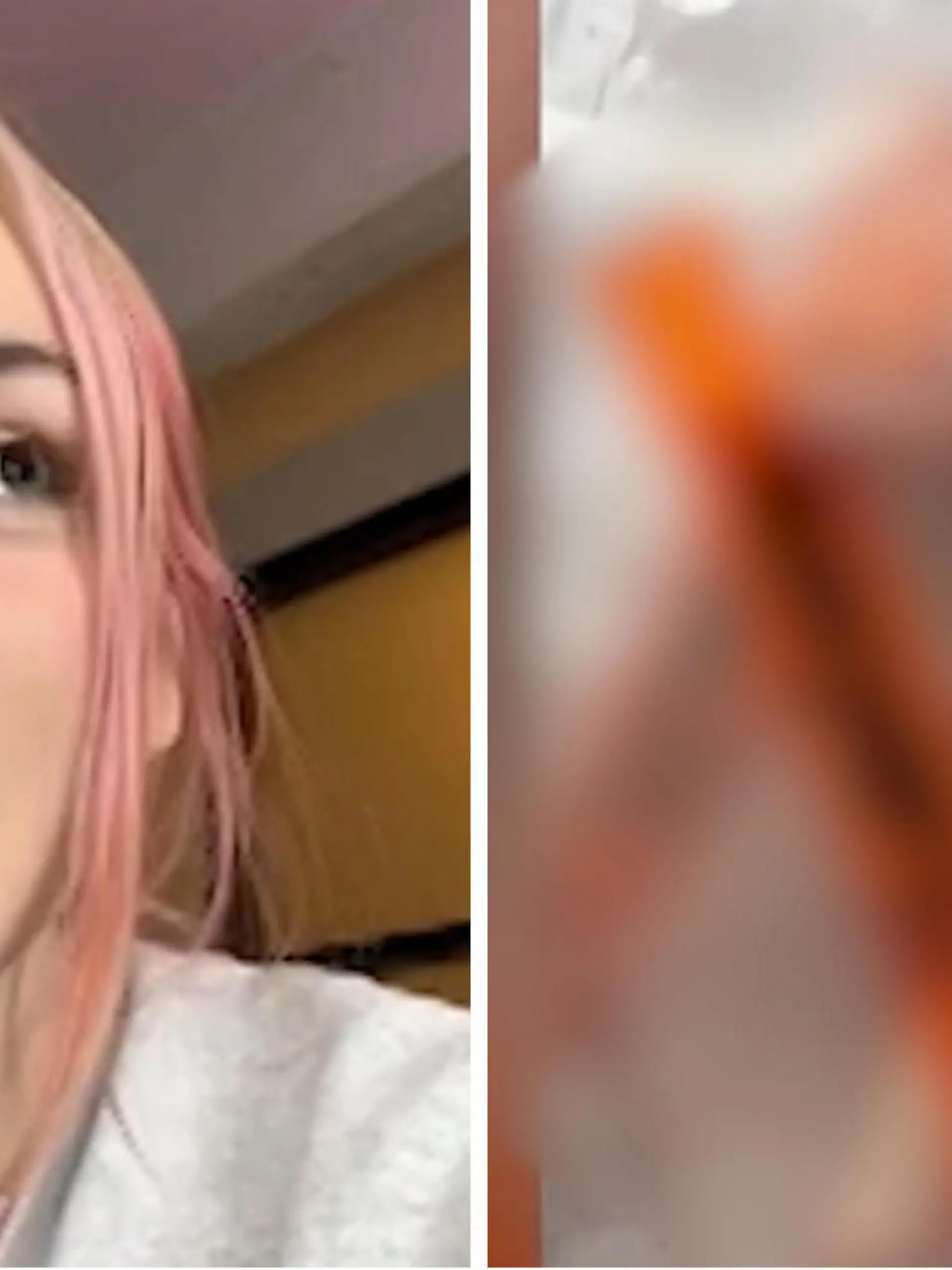 Fotokollage: Links Emily im Selfie-Modus, rechts ihre Rippen in einer Tüte (geblurrt)